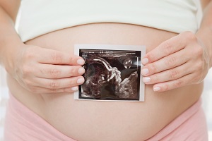 Sindrome di Down: test DNA fetale danno i risultati più sicuri